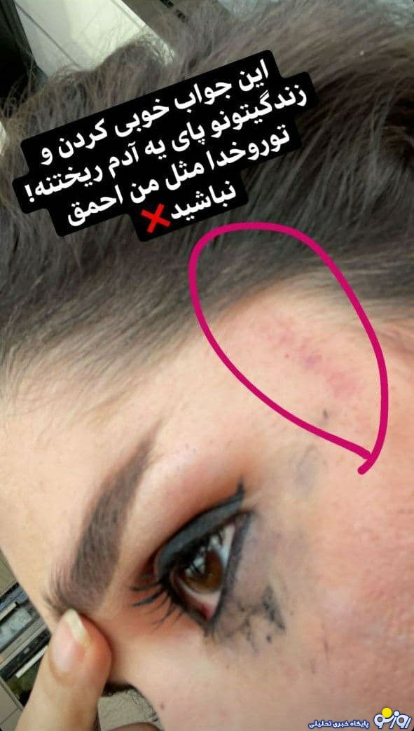 کتک خوردن دنیا جهانبخت از مهراد جم +عکس کتک خوردن دنیا جهانبخت از مهراد جم +عکس