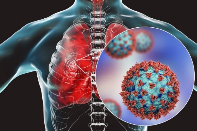 علائم درگیری ریه در مبتلایانِ کرونا