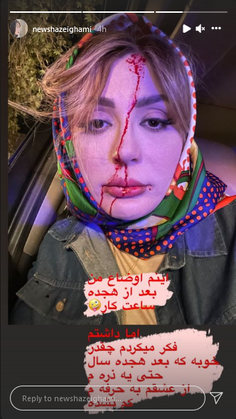 زخمی شدن نیوشا ضیغمی در تصادف/عکس
