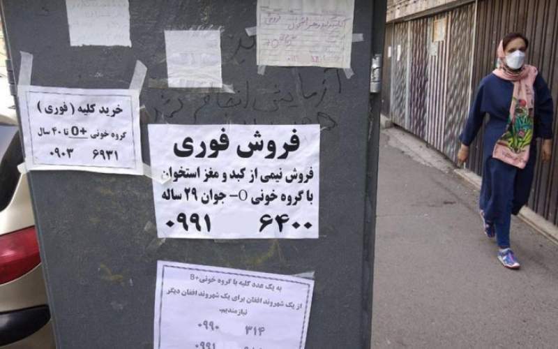قیمت کلیه در ایران ؛ از ۱۰۰ تا ۳۵۰ میلیون تومان