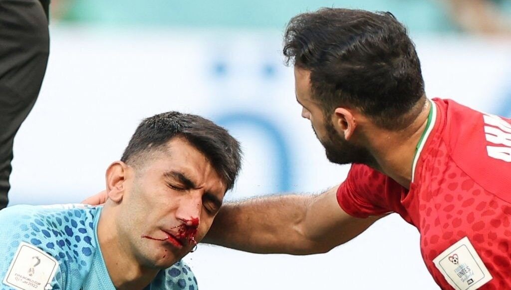 انتقاد شدید از تیم پزشکی ایران پس از مصدومیت بیرانوند