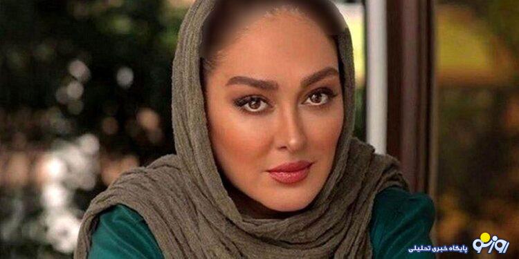 تغییرات زیبای همه صورت الهام حمیدی / ببینید چی بود و فوق جذاب شد ! + ۹ عکس حیرت انگیز !